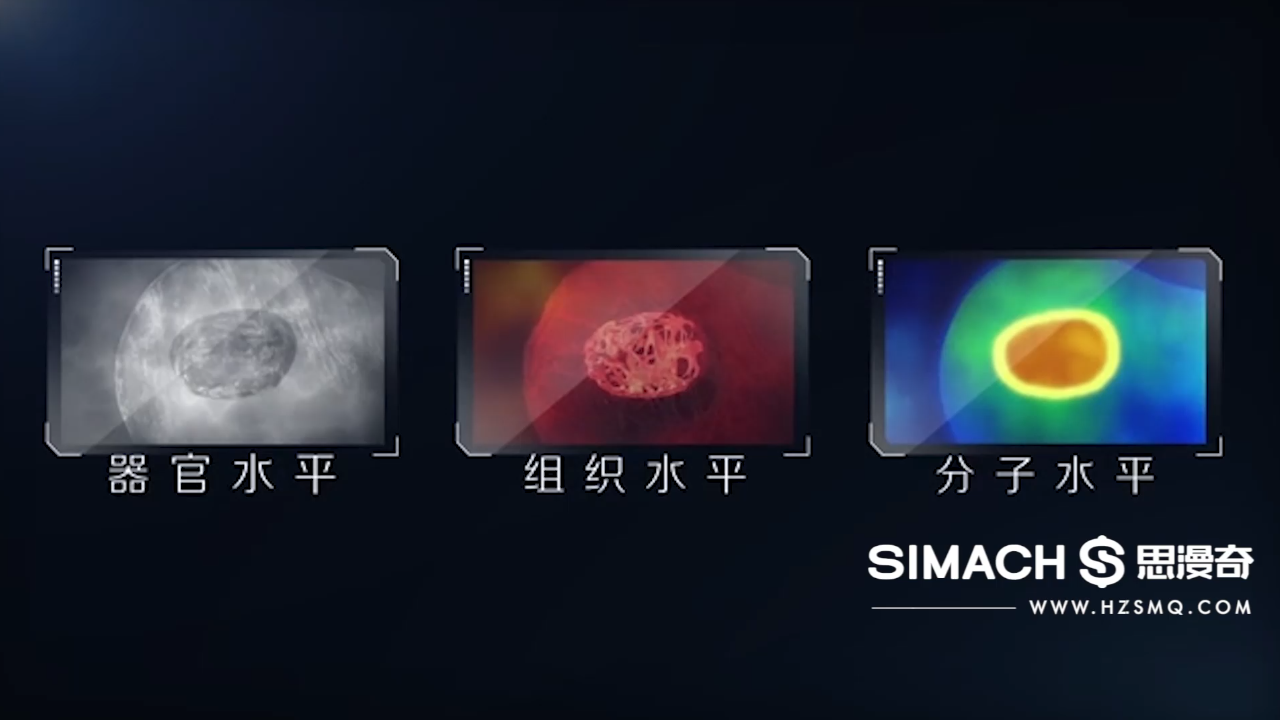 睿迪超声
